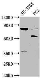 ABLIM1 Antibody in Western Blot (WB)