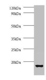 V-ATPase G1 Antibody in Western Blot (WB)