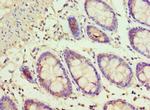 ADSS Antibody in Immunohistochemistry (Paraffin) (IHC (P))