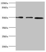 ADSS Antibody in Western Blot (WB)