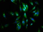 Agrin Antibody in Immunocytochemistry (ICC/IF)