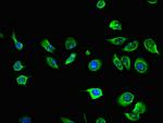 AIM2 Antibody in Immunocytochemistry (ICC/IF)