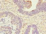 CMG2 Antibody in Immunohistochemistry (Paraffin) (IHC (P))