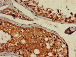 gamma Adaptin Antibody in Immunohistochemistry (Paraffin) (IHC (P))