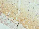 AP2A2 Antibody in Immunohistochemistry (Paraffin) (IHC (P))