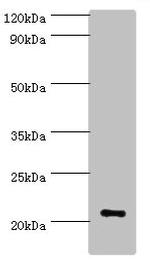 ARF3 Antibody in Western Blot (WB)