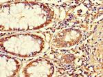 Asporin Antibody in Immunohistochemistry (Paraffin) (IHC (P))