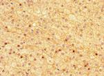 Asporin Antibody in Immunohistochemistry (Paraffin) (IHC (P))