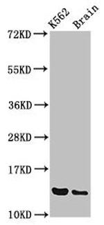 BET1 Antibody in Western Blot (WB)