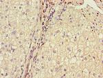 BRP44 Antibody in Immunohistochemistry (Paraffin) (IHC (P))