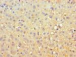 CBR3 Antibody in Immunohistochemistry (Paraffin) (IHC (P))