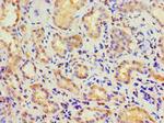 CBR3 Antibody in Immunohistochemistry (Paraffin) (IHC (P))