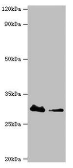 CBR3 Antibody in Western Blot (WB)