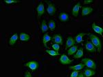 CD151 Antibody in Immunocytochemistry (ICC/IF)