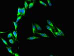 CD37 Antibody in Immunocytochemistry (ICC/IF)