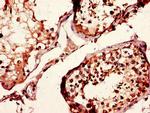 CD37 Antibody in Immunohistochemistry (Paraffin) (IHC (P))