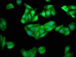 CHKB Antibody in Immunocytochemistry (ICC/IF)