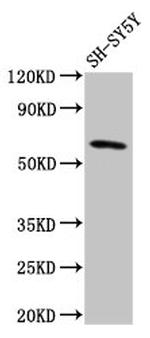 DEAF1 Antibody in Western Blot (WB)