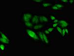 EGR2 Antibody in Immunocytochemistry (ICC/IF)