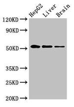 EGR2 Antibody in Western Blot (WB)