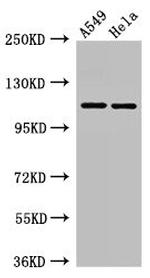 EphA5 Antibody in Western Blot (WB)