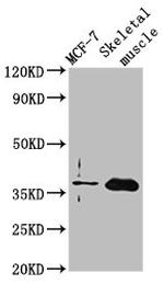 FBP2 Antibody in Western Blot (WB)