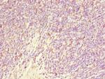 GABRR1 Antibody in Immunohistochemistry (Paraffin) (IHC (P))