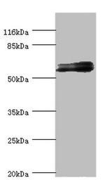 GABRR1 Antibody in Western Blot (WB)
