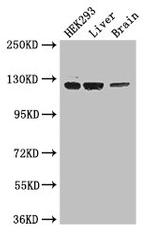 GUCY2C Antibody in Western Blot (WB)