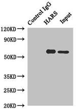 HARS Antibody in Immunoprecipitation (IP)