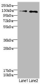 HEPH Antibody in Western Blot (WB)