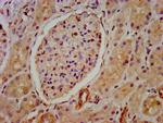 HIP1R Antibody in Immunohistochemistry (Paraffin) (IHC (P))