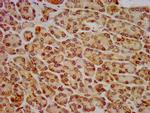 HIP1R Antibody in Immunohistochemistry (Paraffin) (IHC (P))