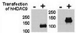 HDAC9 Antibody in Western Blot (WB)