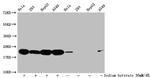 Formyl-Histone H1.2 (Lys96) Antibody in Western Blot (WB)