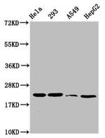 beta-hydroxybutyryl-Histone H1.3 (Lys106) Antibody in Western Blot (WB)