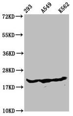 beta-hydroxybutyryl-Histone H1.3 (Lys75) Antibody in Western Blot (WB)