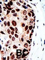 HDAC9 Antibody in Immunohistochemistry (Paraffin) (IHC (P))
