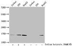 Acetyl-Histone Macro-H2A.1 (Lys9) Antibody in Western Blot (WB)