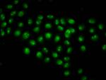 Acetyl-Histone Macro-H2A.1 (Lys13) Antibody in Immunocytochemistry (ICC/IF)