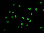 Acetyl-Histone Macro-H2A.1 (Lys74) Antibody in Immunocytochemistry (ICC/IF)