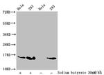 2-hydroxyisobutyryl-Histone Macro-H2A.1 (Lys74) Antibody in Western Blot (WB)