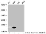 H2BK116ac Antibody in Western Blot (WB)