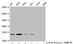 H2BK11ac Antibody in Western Blot (WB)