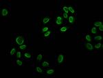 H2BK12ac Antibody in Immunocytochemistry (ICC/IF)