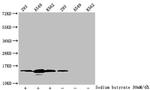 H2BK12ac Antibody in Western Blot (WB)