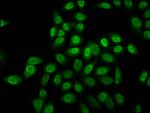 H2BK12cr Antibody in Immunocytochemistry (ICC/IF)