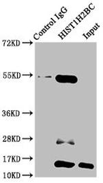 H2BK15ac Antibody in Immunoprecipitation (IP)