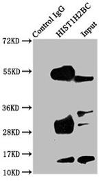 H2BK24ac Antibody in Immunoprecipitation (IP)