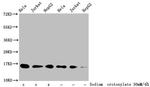 H3K9cr Antibody in Western Blot (WB)